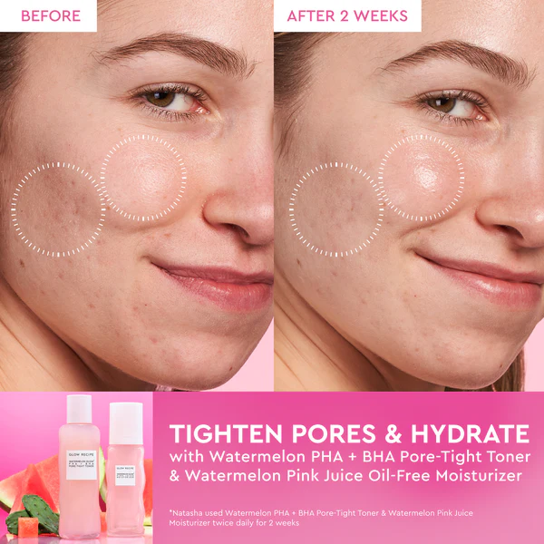 BEAUTILICIOUS Watermelon Glow PHA+BHA Pore-Tight Toner - Image 3